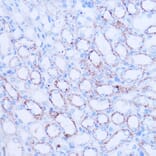 Immunohistochemistry - Anti-SIRT3 Antibody (A92878) - Antibodies.com