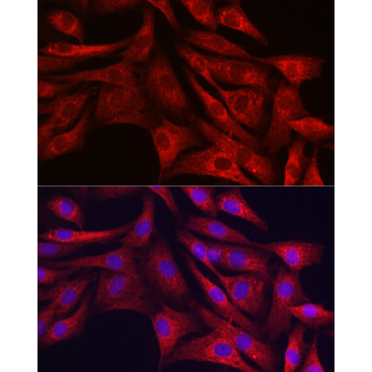 Immunofluorescence - Anti-SIRT3 Antibody (A92878) - Antibodies.com
