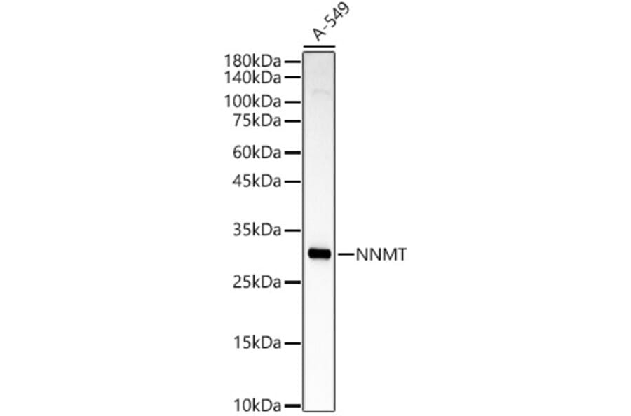 Western Blot - Anti-NNMT Antibody (A92881) - Antibodies.com