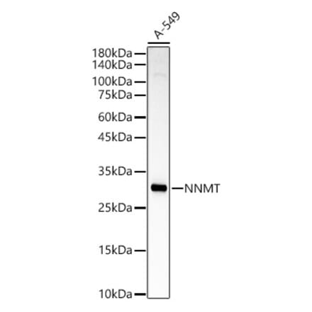 Western Blot - Anti-NNMT Antibody (A92881) - Antibodies.com