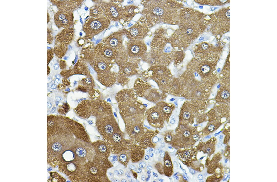 Immunohistochemistry - Anti-NNMT Antibody (A92881) - Antibodies.com