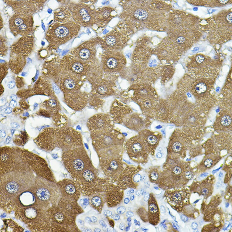 Immunohistochemistry - Anti-NNMT Antibody (A92881) - Antibodies.com