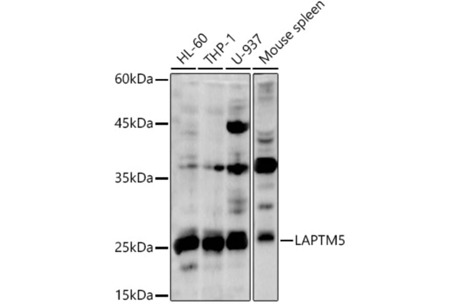 Western Blot - Anti-LAPTM5 Antibody (A92883) - Antibodies.com