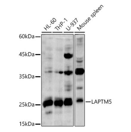 Western Blot - Anti-LAPTM5 Antibody (A92883) - Antibodies.com