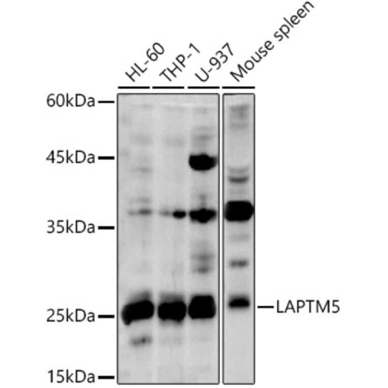 Western Blot - Anti-LAPTM5 Antibody (A92883) - Antibodies.com
