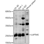 Western Blot - Anti-LAPTM5 Antibody (A92883) - Antibodies.com