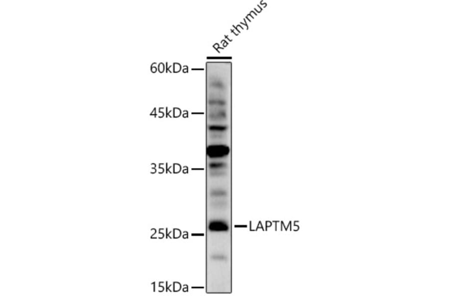 Western Blot - Anti-LAPTM5 Antibody (A92883) - Antibodies.com