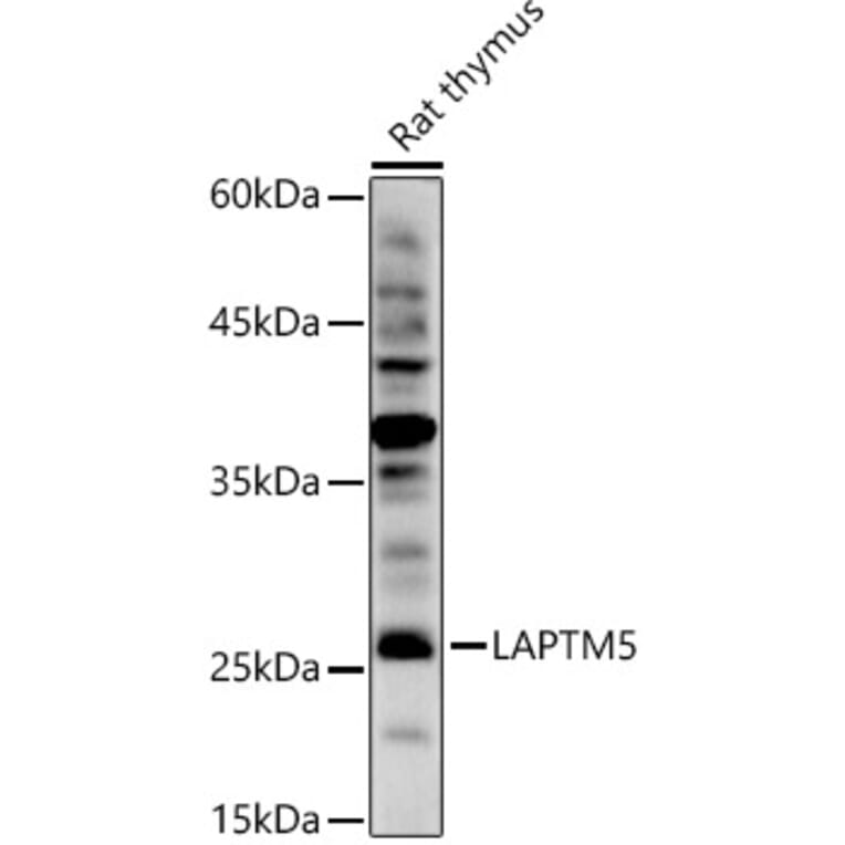 Western Blot - Anti-LAPTM5 Antibody (A92883) - Antibodies.com