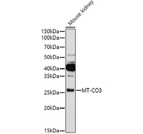 Western Blot - Anti-Complex IV Antibody (A92884) - Antibodies.com