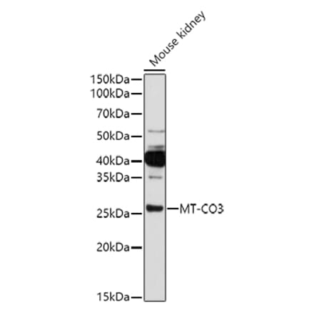 Western Blot - Anti-Complex IV Antibody (A92884) - Antibodies.com