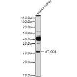 Western Blot - Anti-Complex IV Antibody (A92884) - Antibodies.com