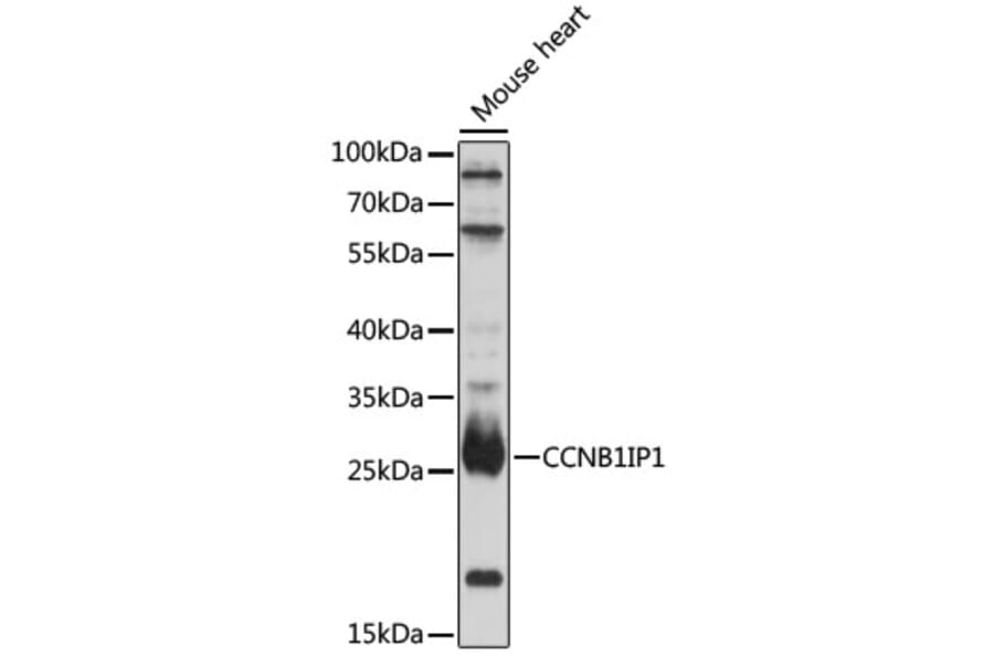 Western Blot - Anti-CCNB1IP1 Antibody (A92885) - Antibodies.com