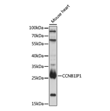 Western Blot - Anti-CCNB1IP1 Antibody (A92885) - Antibodies.com