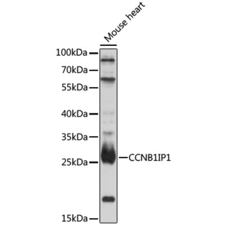 Western Blot - Anti-CCNB1IP1 Antibody (A92885) - Antibodies.com