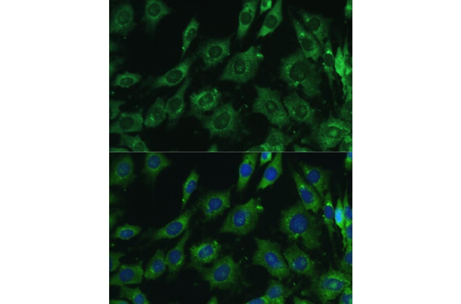 Immunofluorescence - Anti-Galectin 3 Antibody (A92886) - Antibodies.com