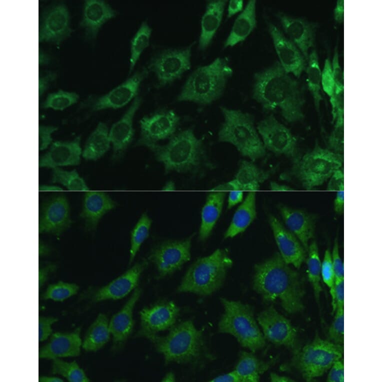 Immunofluorescence - Anti-Galectin 3 Antibody (A92886) - Antibodies.com