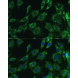 Immunofluorescence - Anti-Galectin 3 Antibody (A92886) - Antibodies.com