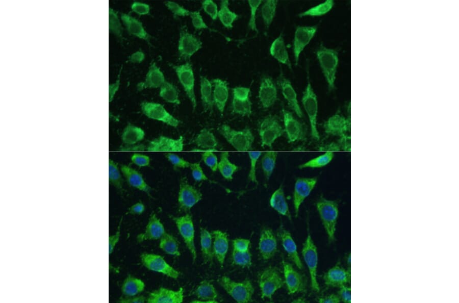 Immunofluorescence - Anti-Galectin 3 Antibody (A92886) - Antibodies.com