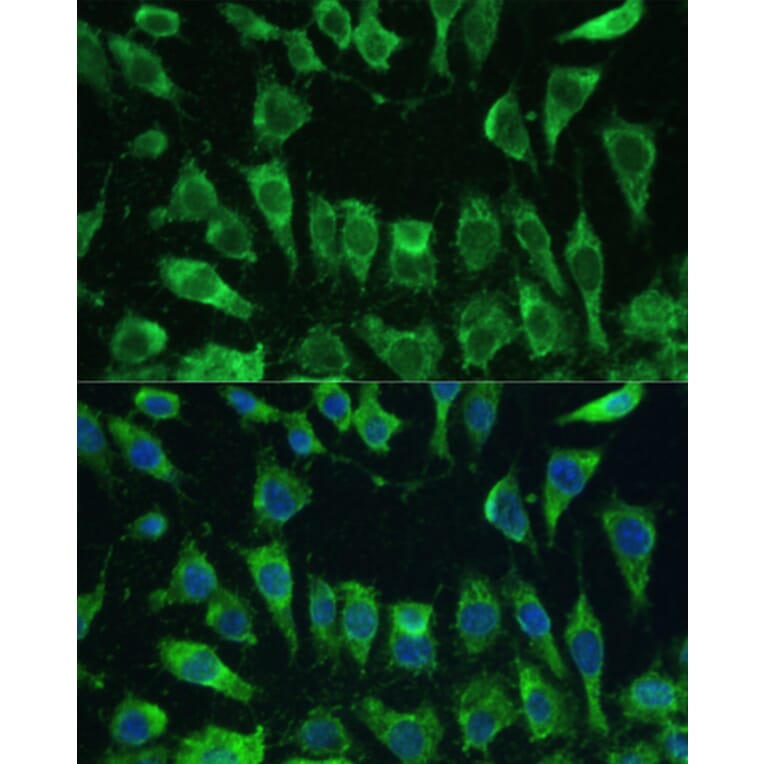 Immunofluorescence - Anti-Galectin 3 Antibody (A92886) - Antibodies.com