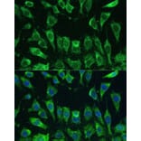 Immunofluorescence - Anti-Galectin 3 Antibody (A92886) - Antibodies.com