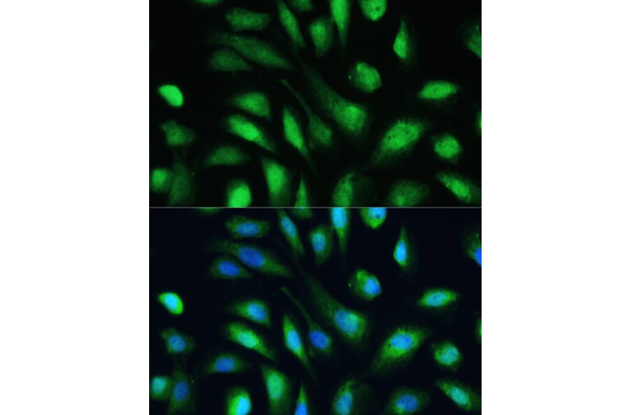 Immunofluorescence - Anti-Galectin 3 Antibody (A92886) - Antibodies.com