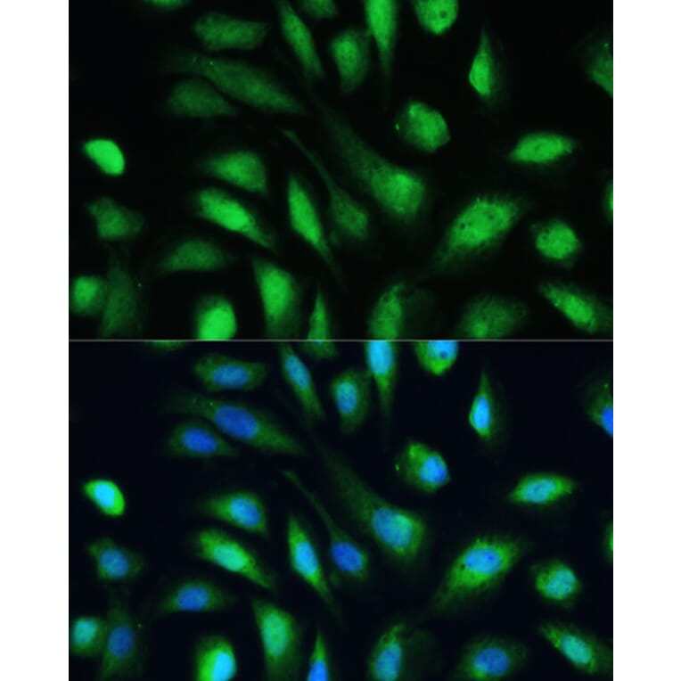 Immunofluorescence - Anti-Galectin 3 Antibody (A92886) - Antibodies.com