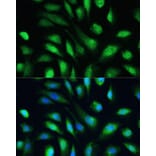 Immunofluorescence - Anti-Galectin 3 Antibody (A92886) - Antibodies.com