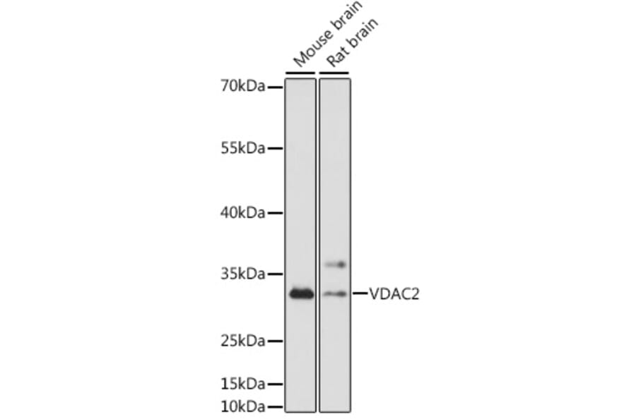 Western Blot - Anti-VDAC2 Antibody (A92888) - Antibodies.com