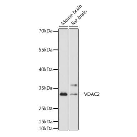 Western Blot - Anti-VDAC2 Antibody (A92888) - Antibodies.com