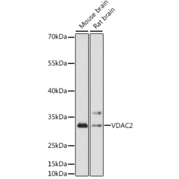 Western Blot - Anti-VDAC2 Antibody (A92888) - Antibodies.com