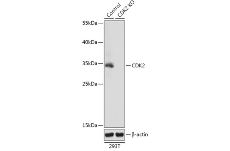 Western Blot - Anti-CDK2 Antibody (A92890) - Antibodies.com