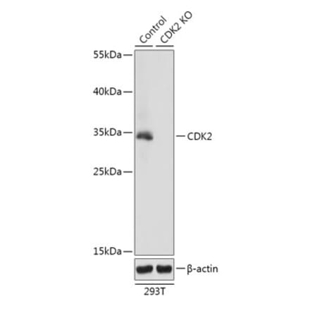 Western Blot - Anti-CDK2 Antibody (A92890) - Antibodies.com