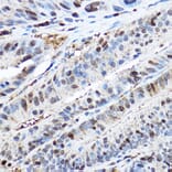 Immunohistochemistry - Anti-CDK2 Antibody (A92890) - Antibodies.com