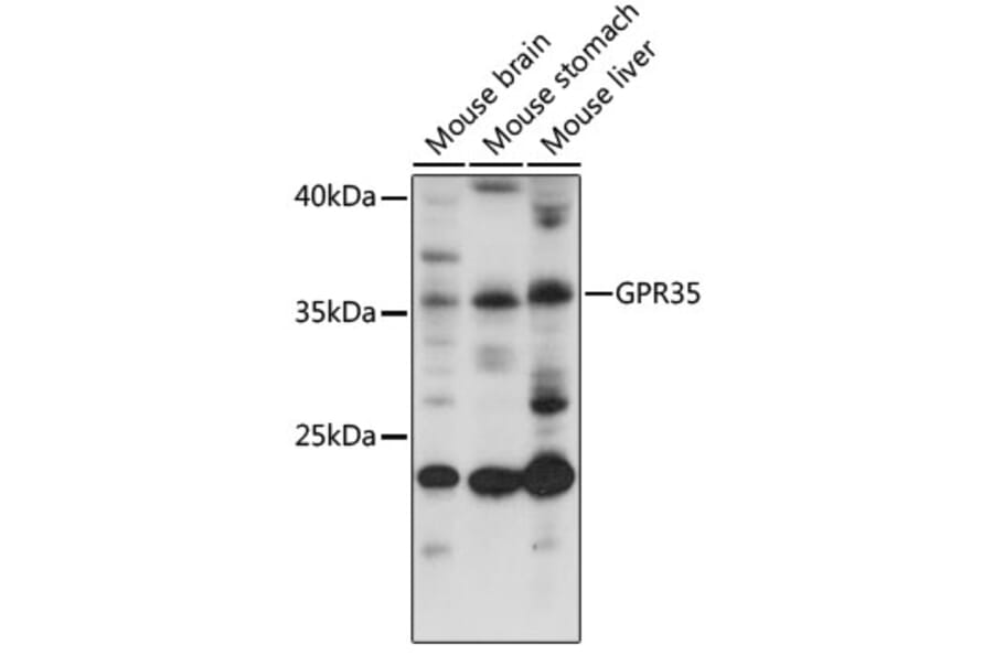 Western Blot - Anti-GPCR GPR35 Antibody (A92891) - Antibodies.com