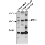 Western Blot - Anti-GPCR GPR35 Antibody (A92891) - Antibodies.com