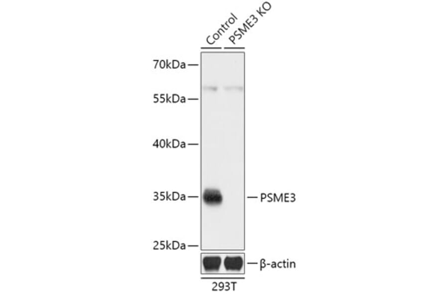 Western Blot - Anti-PSME3 Antibody (A92892) - Antibodies.com
