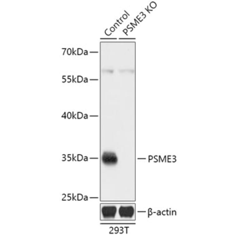 Western Blot - Anti-PSME3 Antibody (A92892) - Antibodies.com