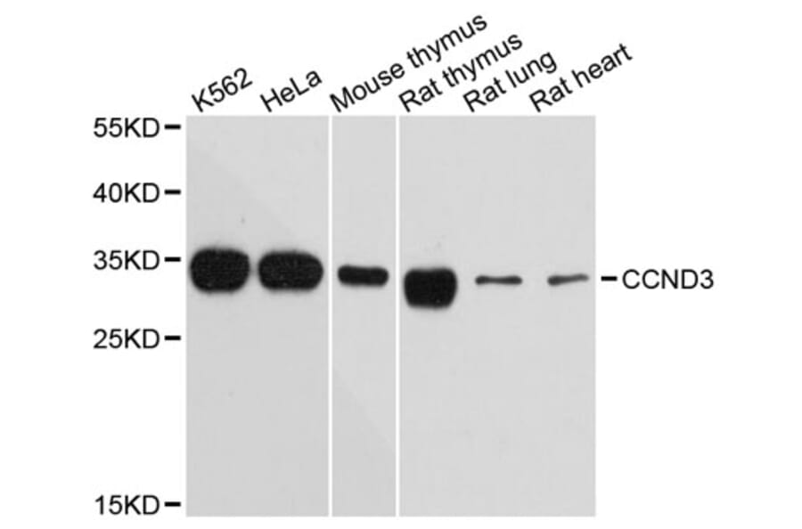 Western Blot - Anti-CCND3 Antibody (A12974) - Antibodies.com