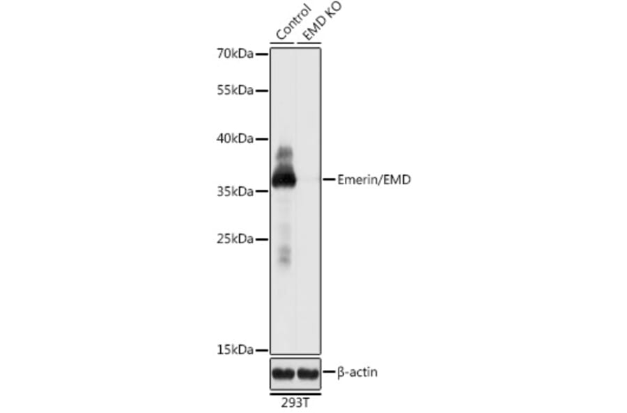 Western Blot - Anti-Emerin Antibody (A92894) - Antibodies.com