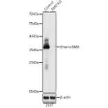 Western Blot - Anti-Emerin Antibody (A92894) - Antibodies.com