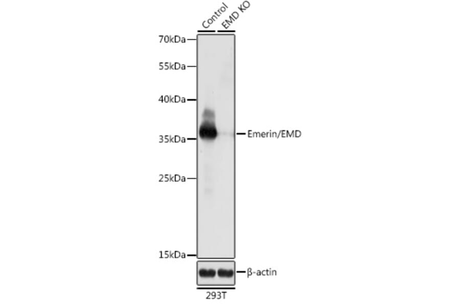 Western Blot - Anti-Emerin Antibody (A92895) - Antibodies.com