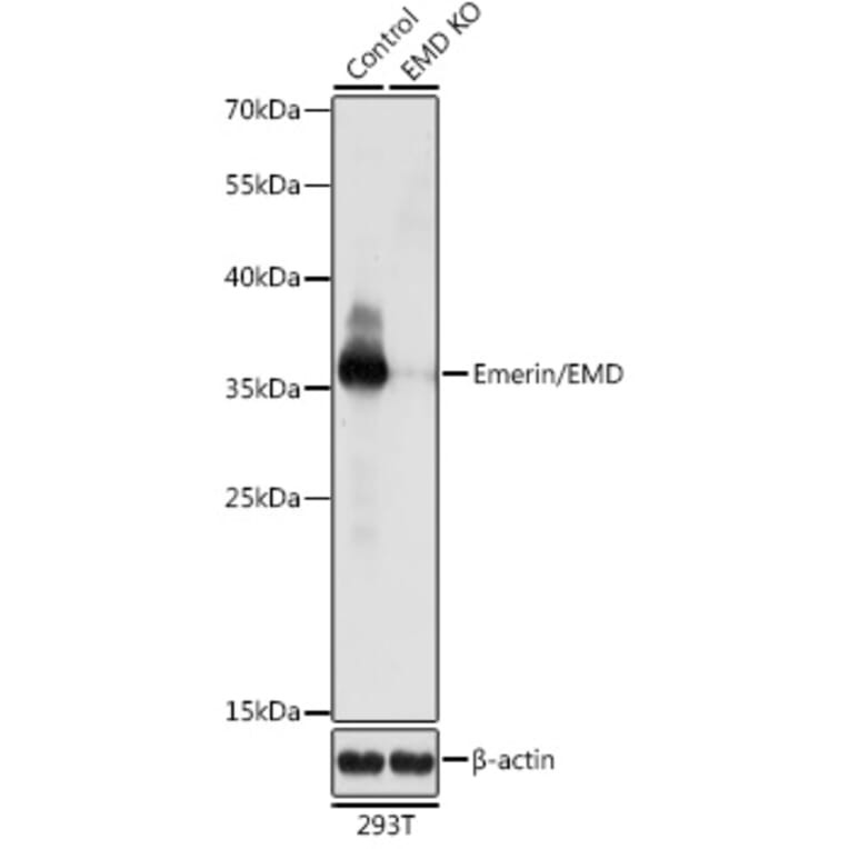 Western Blot - Anti-Emerin Antibody (A92895) - Antibodies.com