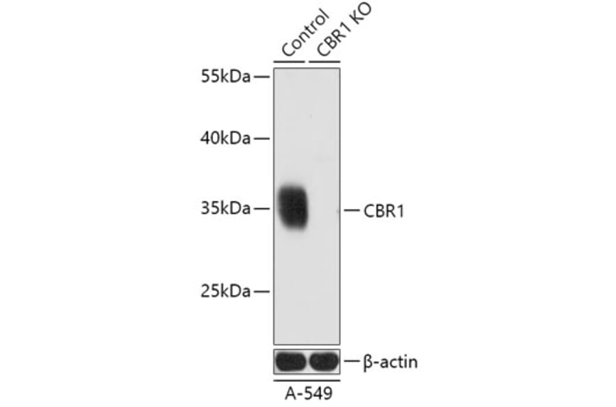 Western Blot - Anti-CBR1 Antibody (A92896) - Antibodies.com