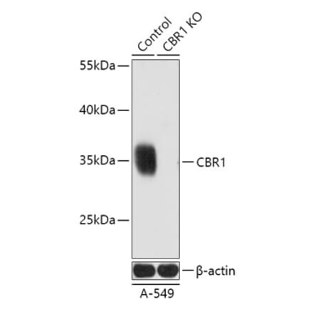Western Blot - Anti-CBR1 Antibody (A92896) - Antibodies.com