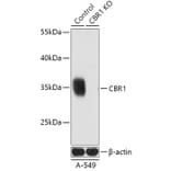 Western Blot - Anti-CBR1 Antibody (A92896) - Antibodies.com