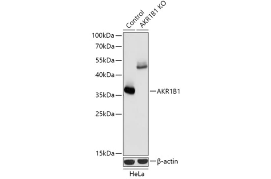 Western Blot - Anti-Aldose reductase Antibody (A92897) - Antibodies.com