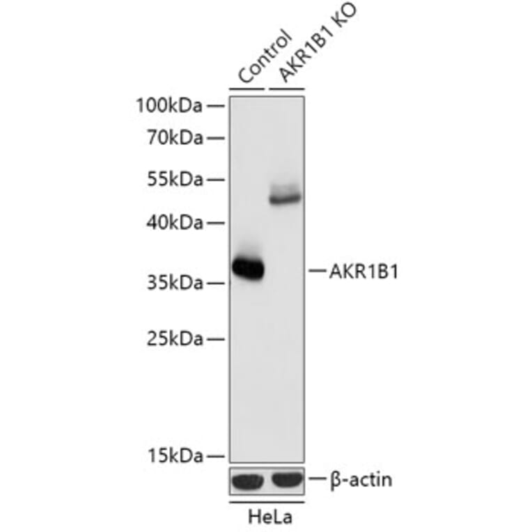 Western Blot - Anti-Aldose reductase Antibody (A92897) - Antibodies.com