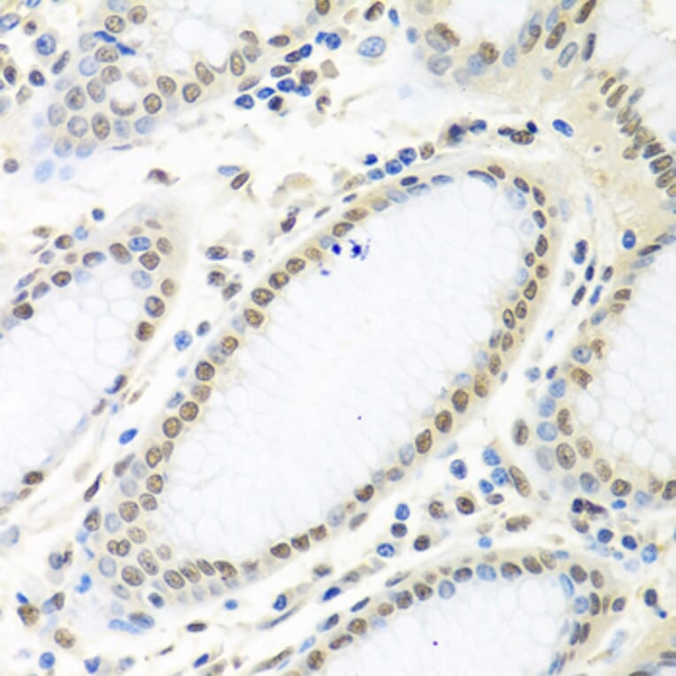Immunohistochemistry - Anti-HuR/ELAVL1 Antibody (A92898) - Antibodies.com