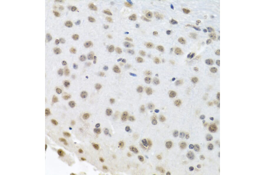 Immunohistochemistry - Anti-HuR/ELAVL1 Antibody (A92898) - Antibodies.com