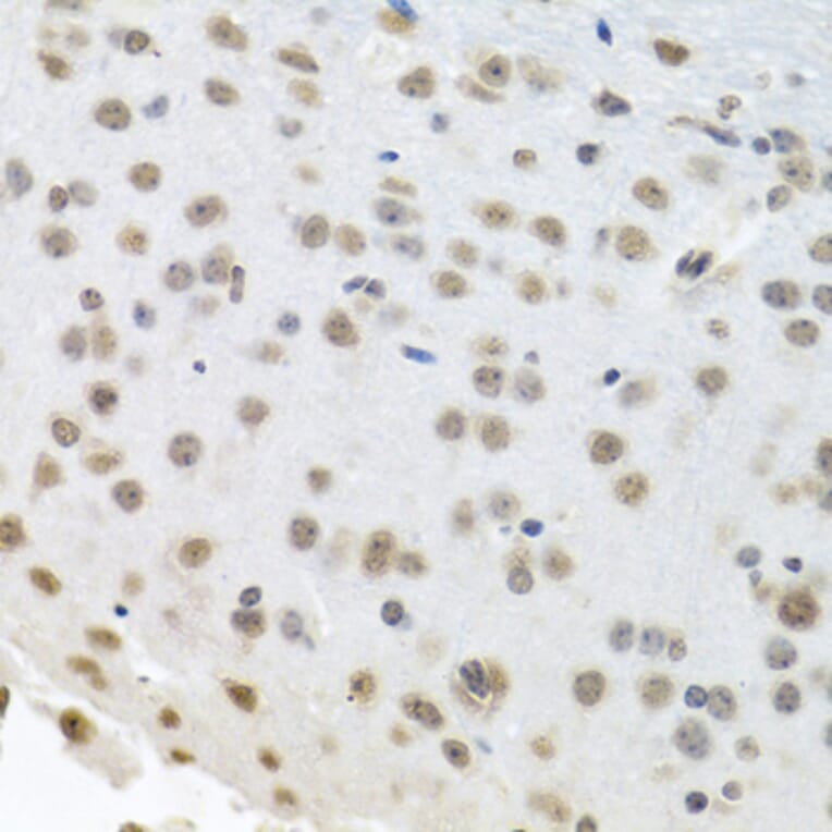 Immunohistochemistry - Anti-HuR/ELAVL1 Antibody (A92898) - Antibodies.com